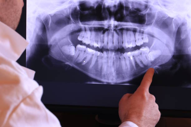 Best Urgent Tooth Repair  in Eagle Mountain, UT