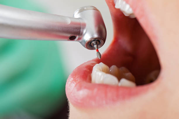 Best Tooth Infection Emergency Dentist  in Eagle Mountain, UT